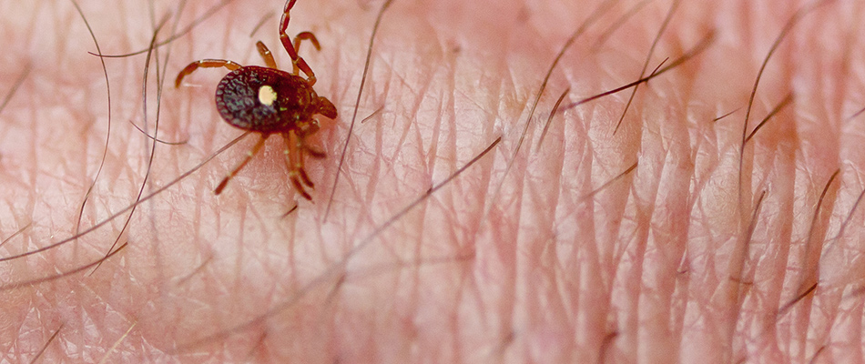 A tick is crawling on a person's skin found in Austin, TX.